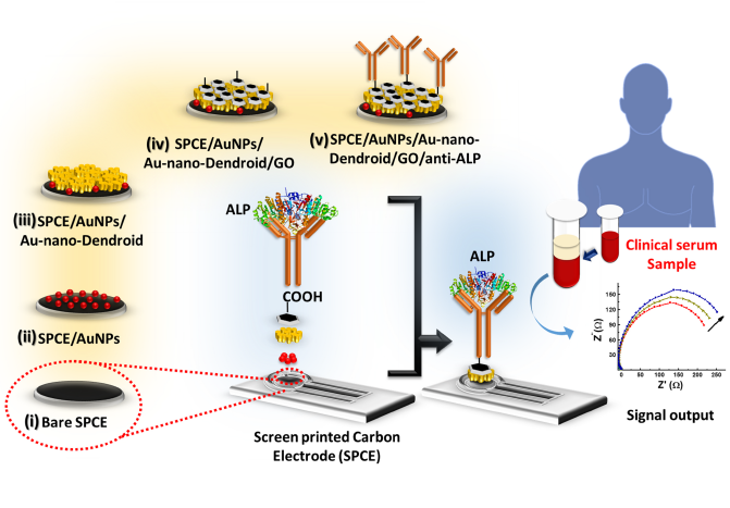 Graphical abstract: screen-printed carbon electrode modified with gold nano-dendroids and graphene oxide detecting alkaline phosphatase in clinical serum